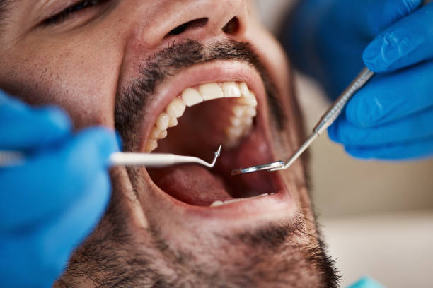 Best Emergency Dental Care for Broken or Chipped Teeth in Roanoke, TX